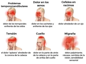 causas del dolor de cabeza segun la zona de la cabeza