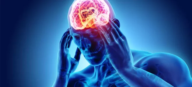 persona con dolor de cabeza en forma de Rayos X con cerebro iluminado